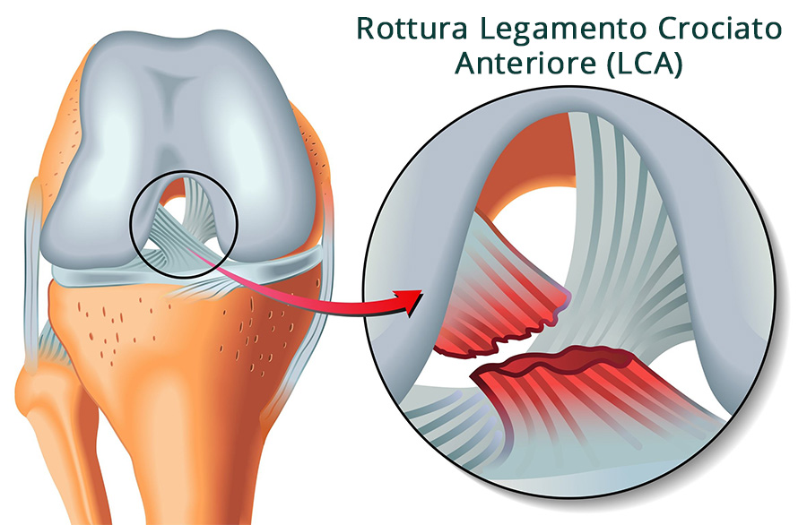 La rottura tra X e Y: cosa è successo davvero?